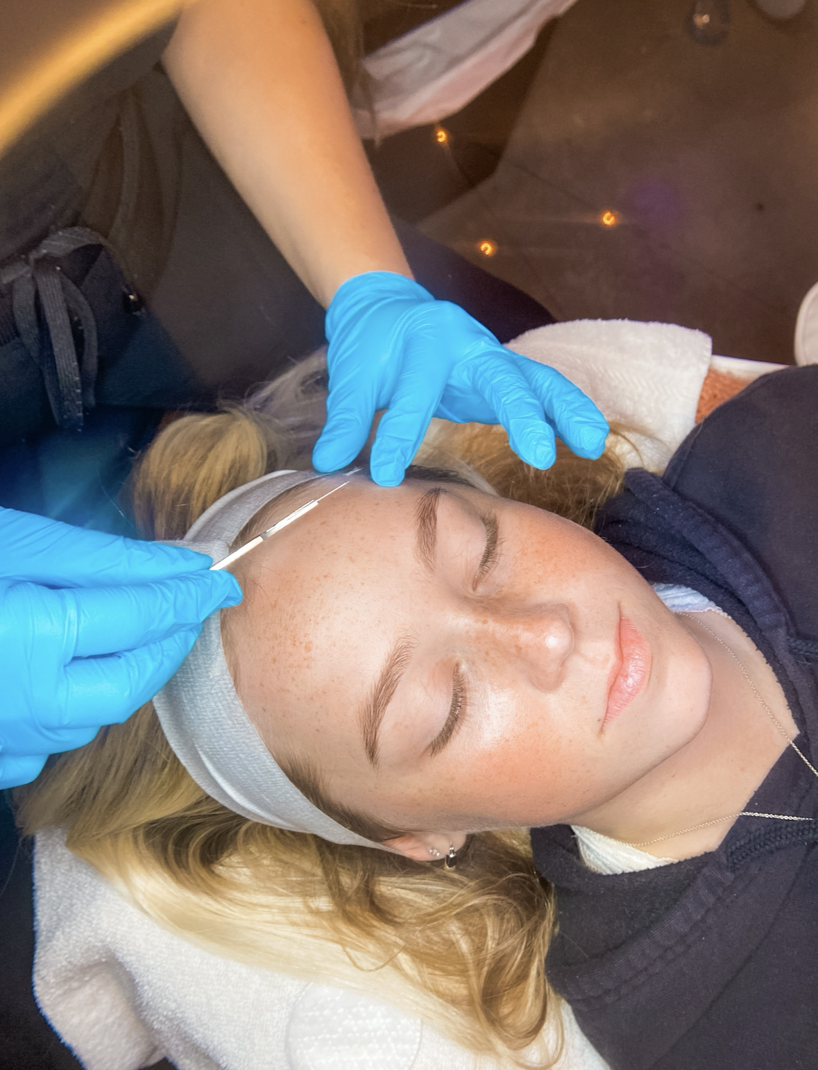 A Shine Starkville esthetician performing a dermaplane treatment on a relaxed client